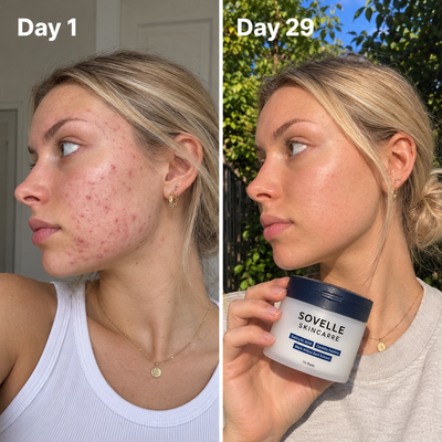 Sovelle Clear Pads