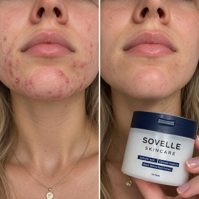 Sovelle Clear Pads